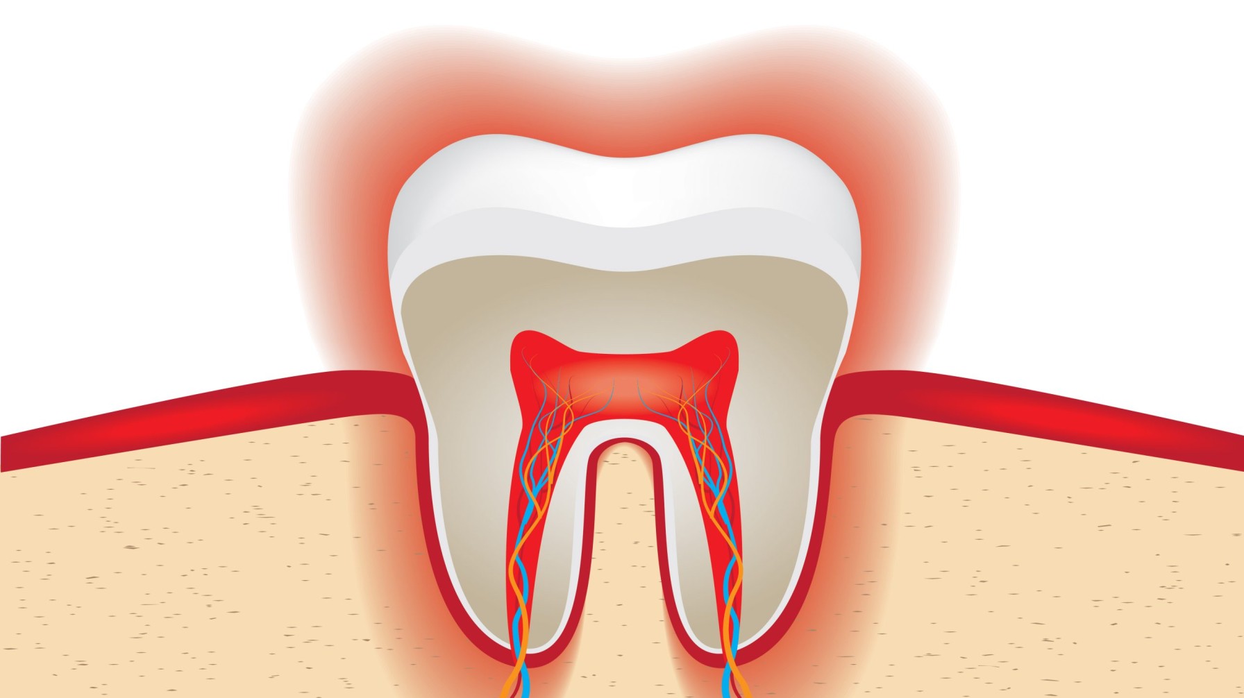 Tooth Sensitivity